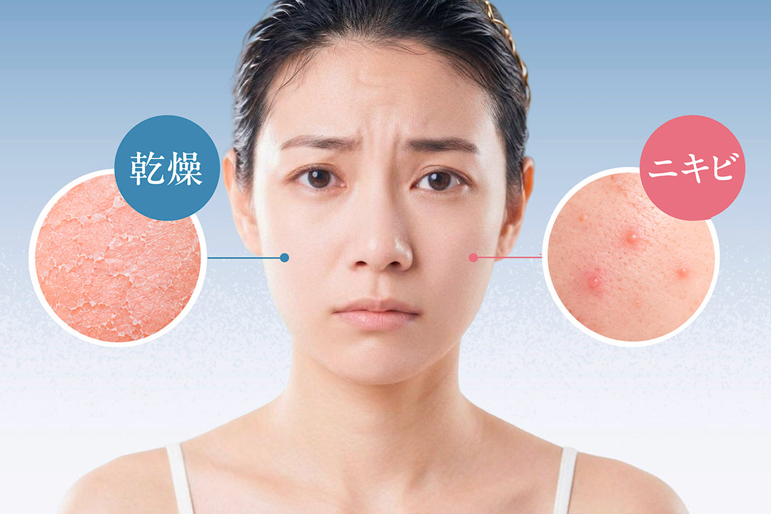 乾燥肌ニキビに悩む人のスキンケア｜洗浄（洗顔・クレンジング）の基本とは？
