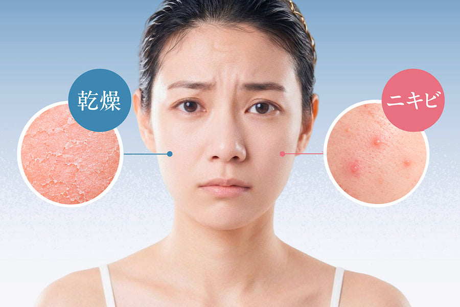 乾燥肌ニキビに悩む人のスキンケア｜洗浄（洗顔・クレンジング）の基本とは？