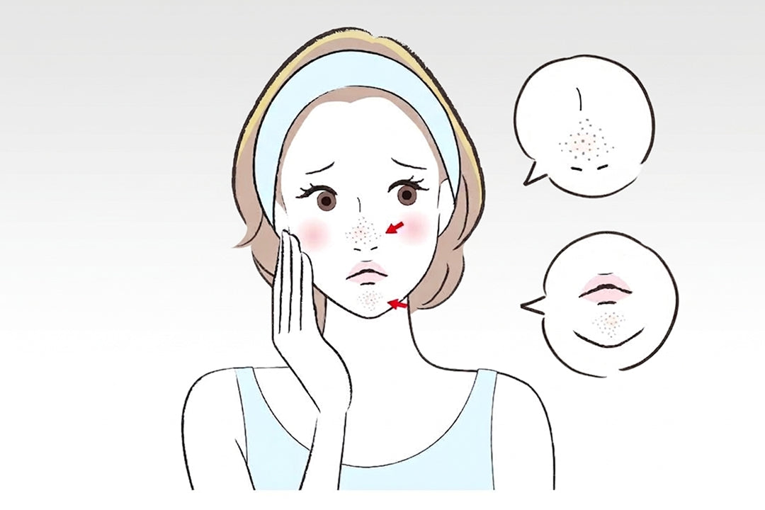 繰り返す鼻や顎の角栓はなぜできる？できやすい原因と見直したいスキンケア習慣