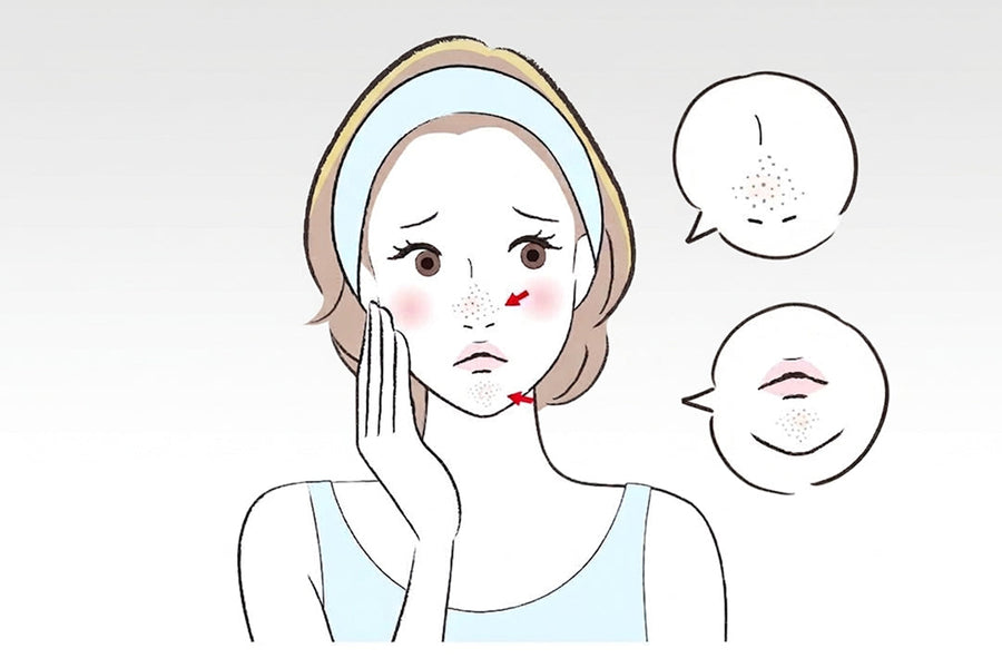 繰り返す鼻や顎の角栓はなぜできる？できやすい原因と見直したいスキンケア習慣